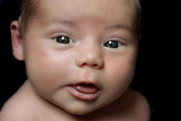 Косоглазие у детей до года 