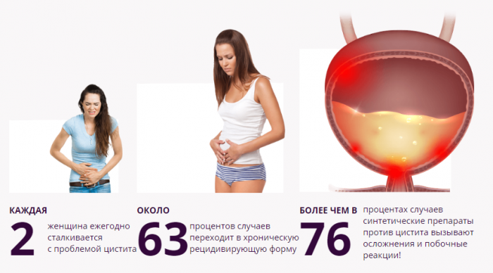 Как лечить цистит у женщин 