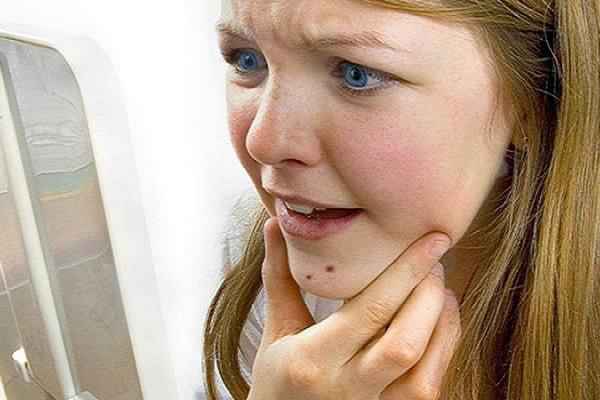 Что означают прыщи на лице: на носу, подбородке лбу, щеках 