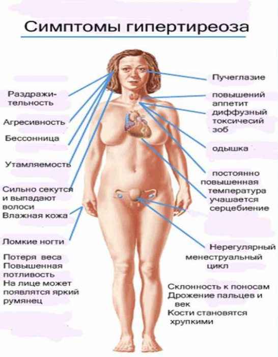 Гипертиреоз и всё о нём симптоматика 