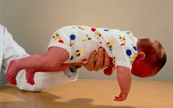 Мышечный тонус 