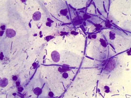 Как распознать гарднерелу 