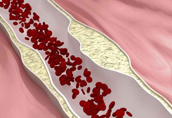 Диета для снижения холестерина 