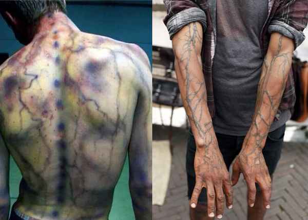 Здоровье ребёнка: если ребёнка поразила молния, советы 