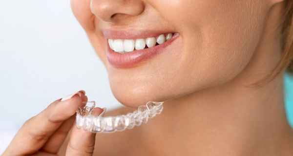 Исправление прикуса, методы и способы 