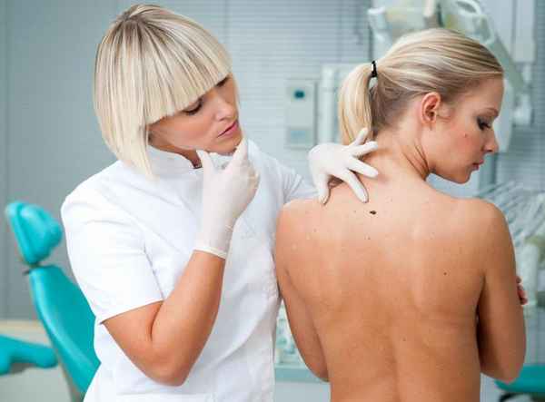 Причины появления родинок на теле: почему и когда появляются 