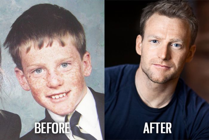 Гадкий утёнок: ребёнок считает себя некрасивым, советы родителям 