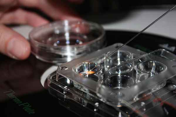 Донорство яйцеклетки: последствия, как стать донором, отзывы 