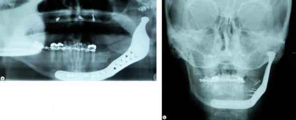 Что такое амeблостома: классификация, диагностика и лечение 