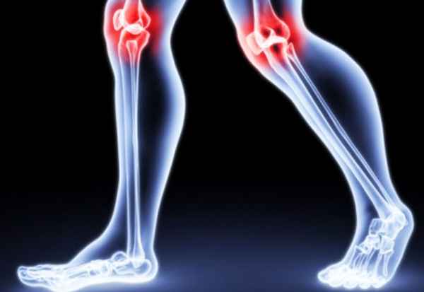 Что делать, если скрипят суставы? 