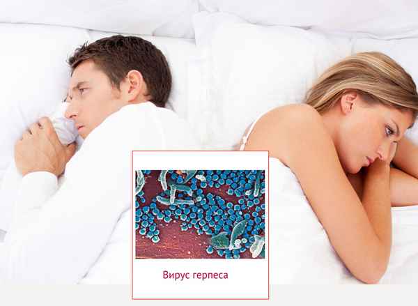 Лечим гepпeс сами 