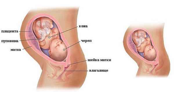 Плацента по передней стенке (предлежание, расположение, прикрепление) 
