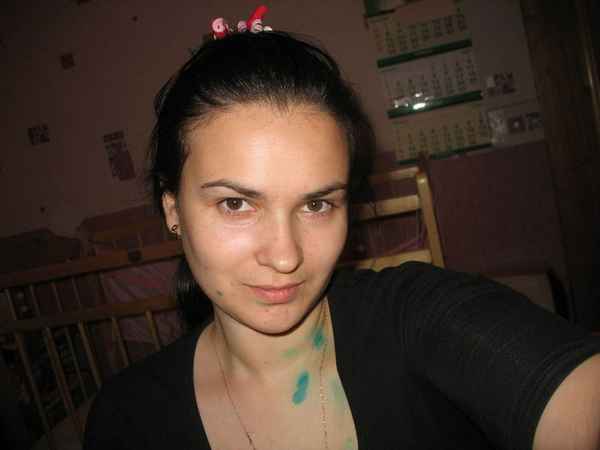 Опасна ли ветрянка при беременности? 