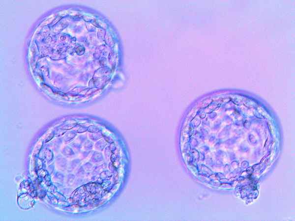 ХГЧ после переноса эмбрионов: таблица, рост, значение ХГЧ 