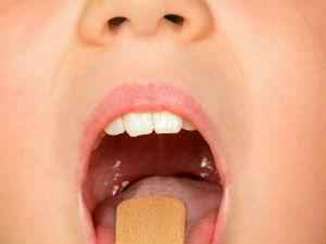 Гнойная ангина: сколько длится, причины, антибиотики для лечения