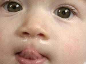 Прозрачные сопли у ребенка и взрослого: лечение слизи и выделений из носа