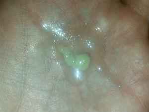 Гнойные сопли у взрослого, причины насморка с гноем