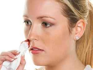 Кровь в носу: почему бывает засохшая по утрам (причины запекшейся)