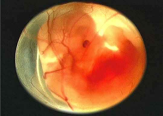 Чудо зарождения души