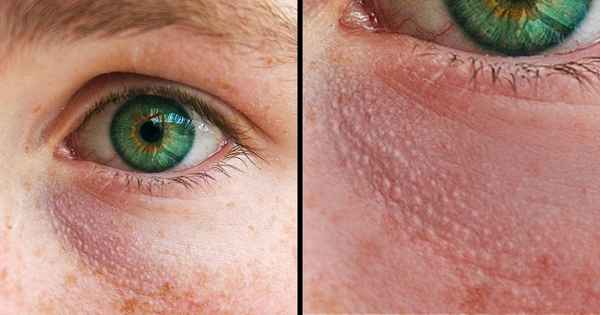 5 простых тестов, которые помогут выявить скрытые проблемы с осанкой (А заодно