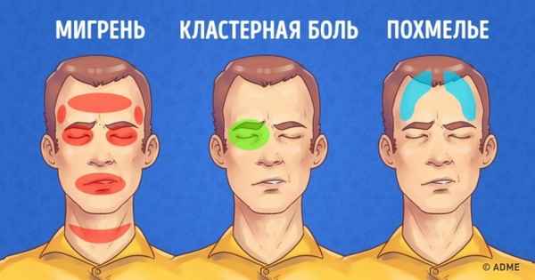 5 типов головной боли и способы быстро от них избавиться
