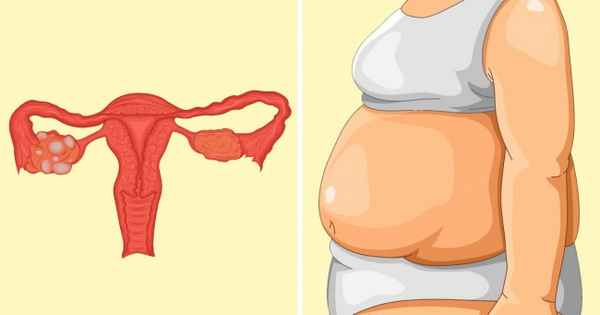 7 недугов, из-за которых не получается избавиться от лишних килограммов