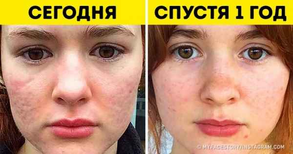 8 компонентов в косметике, которые действительно работают