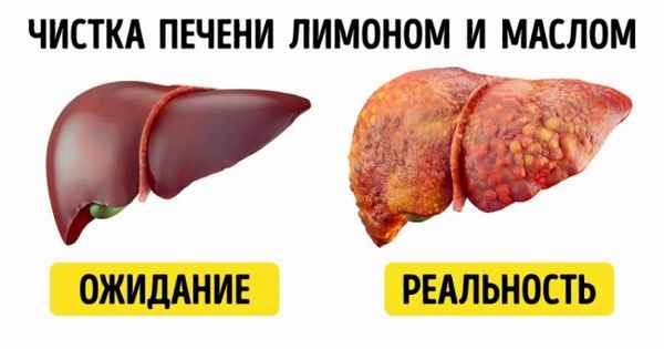 8 народных методов лечения, опасных для вашего здоровья