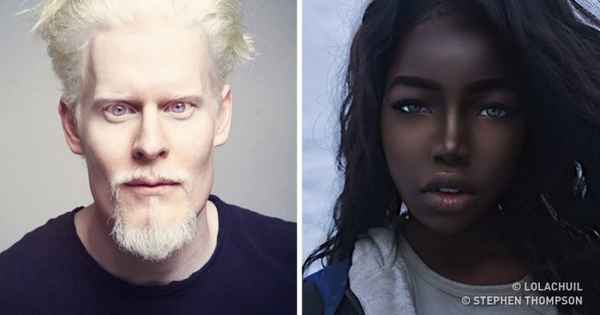 8 обворожительных людей с уникальным цветом кожи