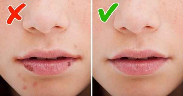 8 сигналов тела, которые помогают понять, каких витаминов не хватает вашему организму