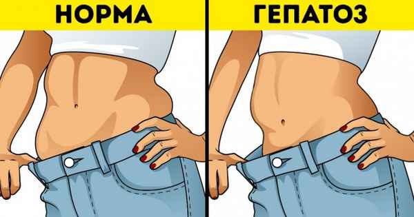 8 тестов для проверки здоровья, которые можно сделать не выходя из дома