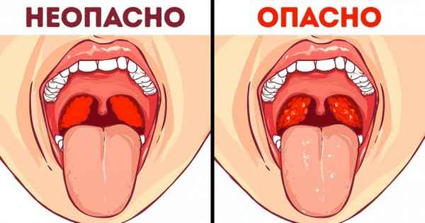 9 «опасных» симптомов, которых на самом деле не стоит бояться (Спойлер: с болью в гpyди не все так просто)