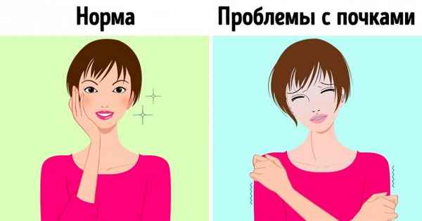 9 неочевидных симптомов, которые говорят о том, что с почками что-то не в порядке