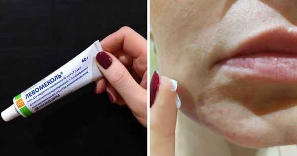 10 аптечных средств, которые продлят вашу молодость и помогут сэкономить кучу денег на салонах красоты