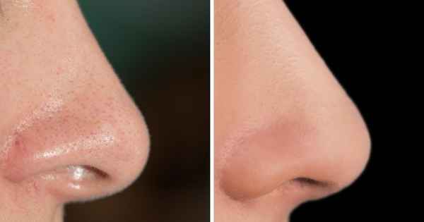 10 домашних масок, эффект от которых не хуже, чем от салонных процедур