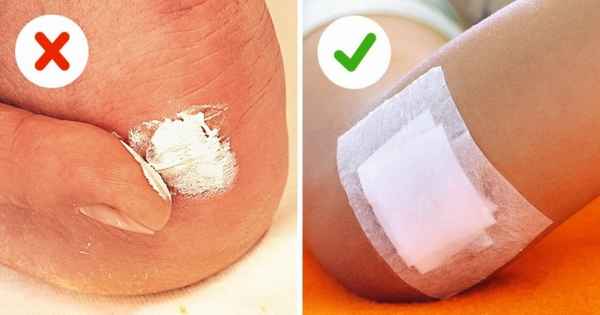 10 мифов о первой помощи, которые могут привести к плохим последствиям