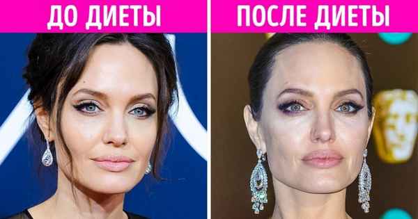 10 побочных эффектов быстрых диет (Спойлер: потерянные килограммы того не стоят)