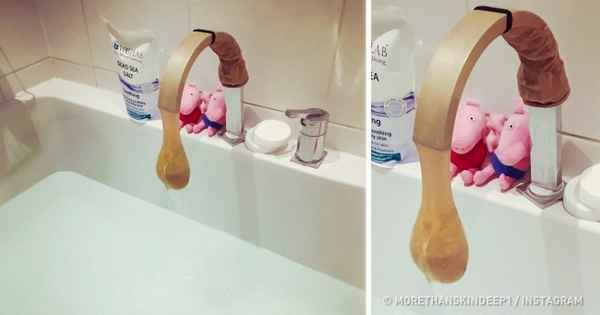 10 подручных средств, которые отлично подойдут для оказания первой помощи