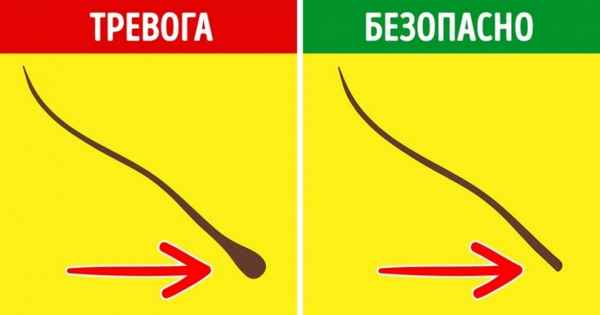 10 причин, почему выпадают волосы, и как это остановить