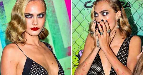 11 женщин, которые блистают в мире моды, несмотря на физические изъяны