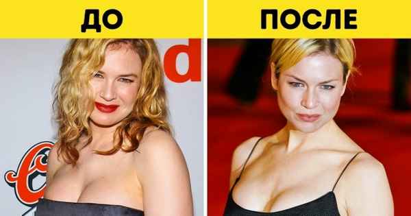 11 неожиданных изменений, которые произойдут с вами, если принимать рыбий жир каждый день