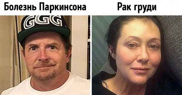 15 знаменитостей, которых не сломили даже серьезные проблемы со здоровьем