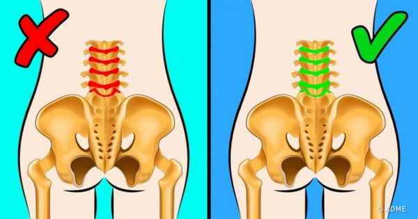 Вам понадобится 5 минут, чтобы избавиться от острой боли в пояснице
