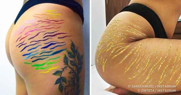 Как предотвратить появление растяжек и что делать, если они уже есть