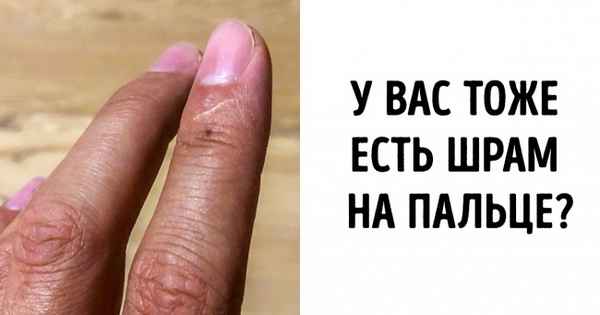 Люди в сети вдруг осознали, что у каждого есть шрам на указательном пальце и еще пара странностей на теле