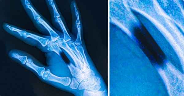 Непредсказуемые побочные эффекты, которые могут возникнуть после укусов животных