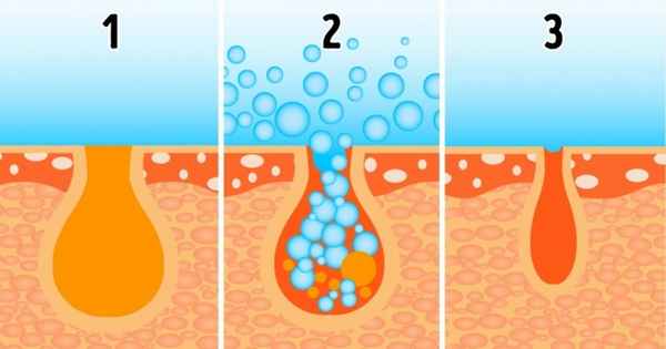 Откуда берутся расширенные поры и как добиться гладкой кожи без дорогих салонных процедур