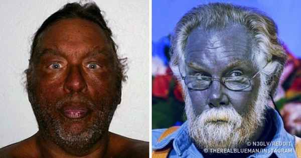 Эти 10 человек поставили над собой пугающие эксперименты, но доказали очень важные вещи